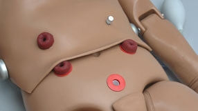 Stoma Care Practice
