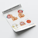 Switch Shaken Baby Syndrome Chart / Poster 3 image