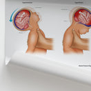 Switch Shaken Baby Syndrome Chart / Poster 2 image