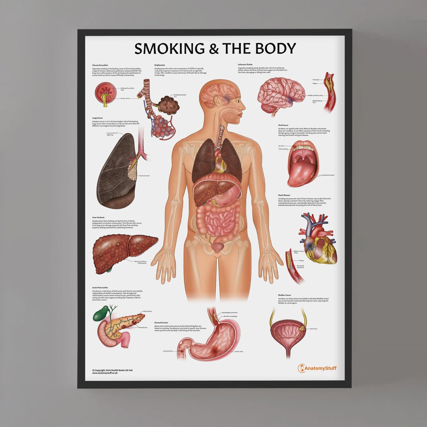 Smoking and The Body Chart / Poster - Part of Collection