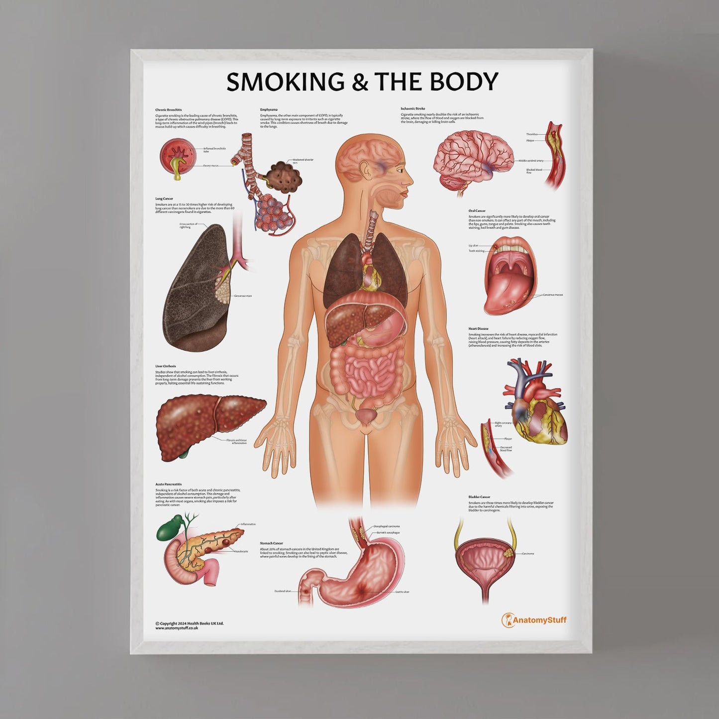 Smoking and The Body Chart / Poster - Part of Collection
