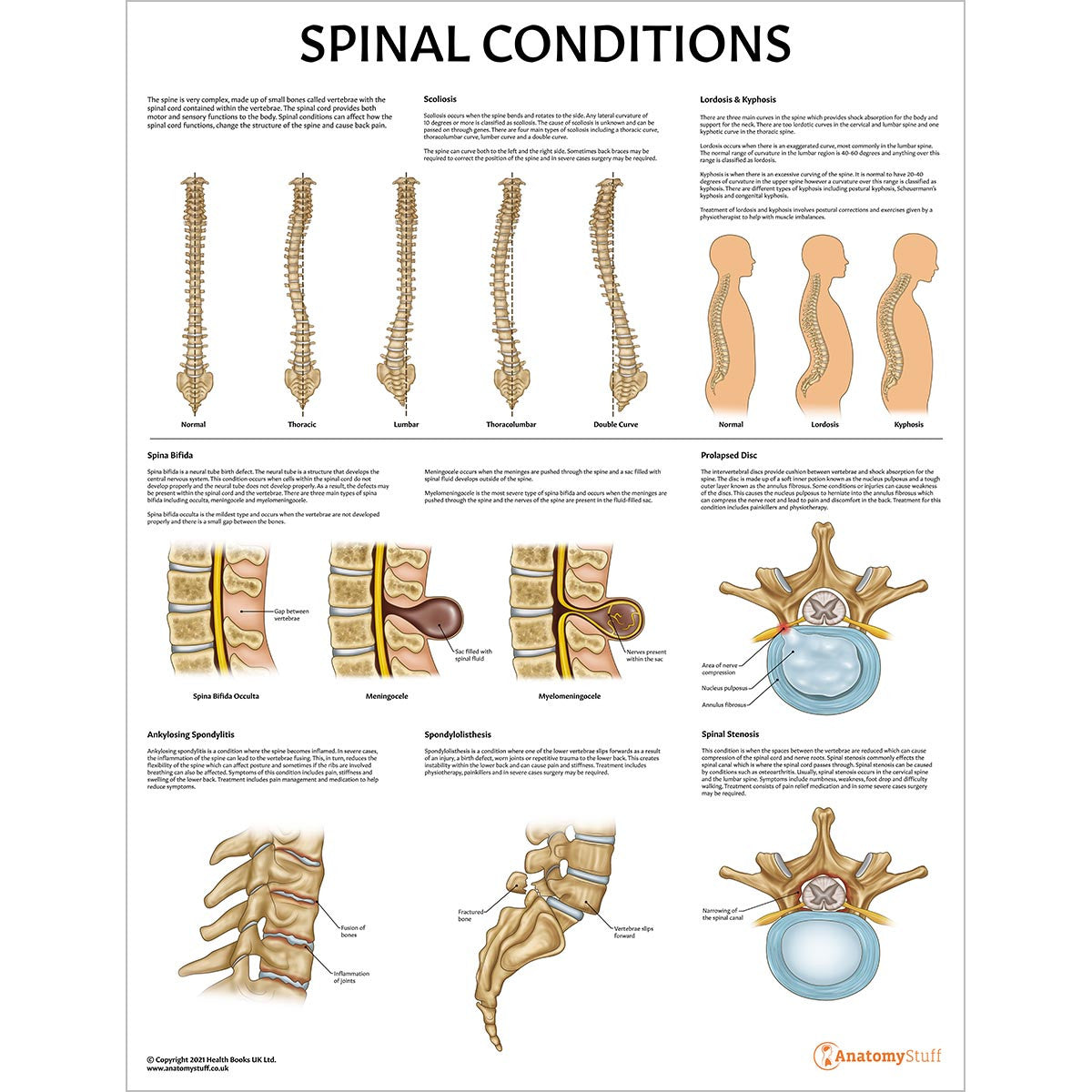 Spine Anatomy & Pathology Collection | Skull and Spinal Nerves Chart ...