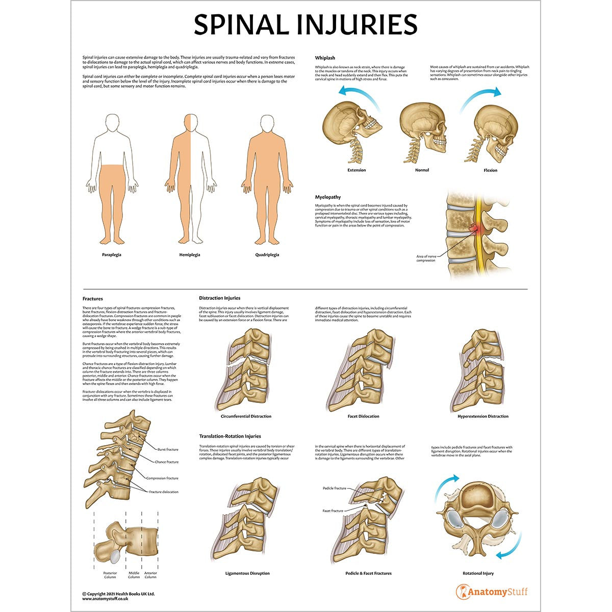 Spine Anatomy & Pathology Collection | Skull and Spinal Nerves Chart ...