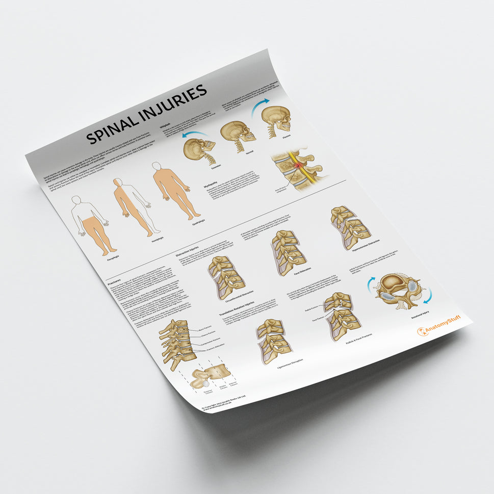 Spinal Injuries Chart / Poster