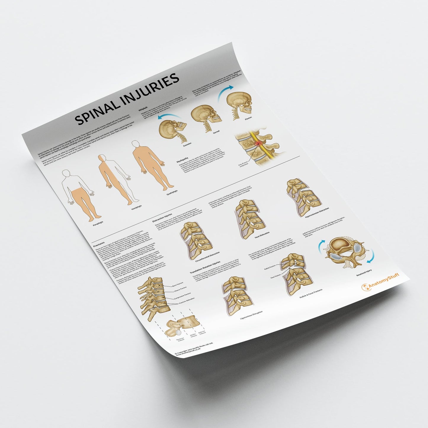 Spinal Injuries Chart / Poster - Part of Collection