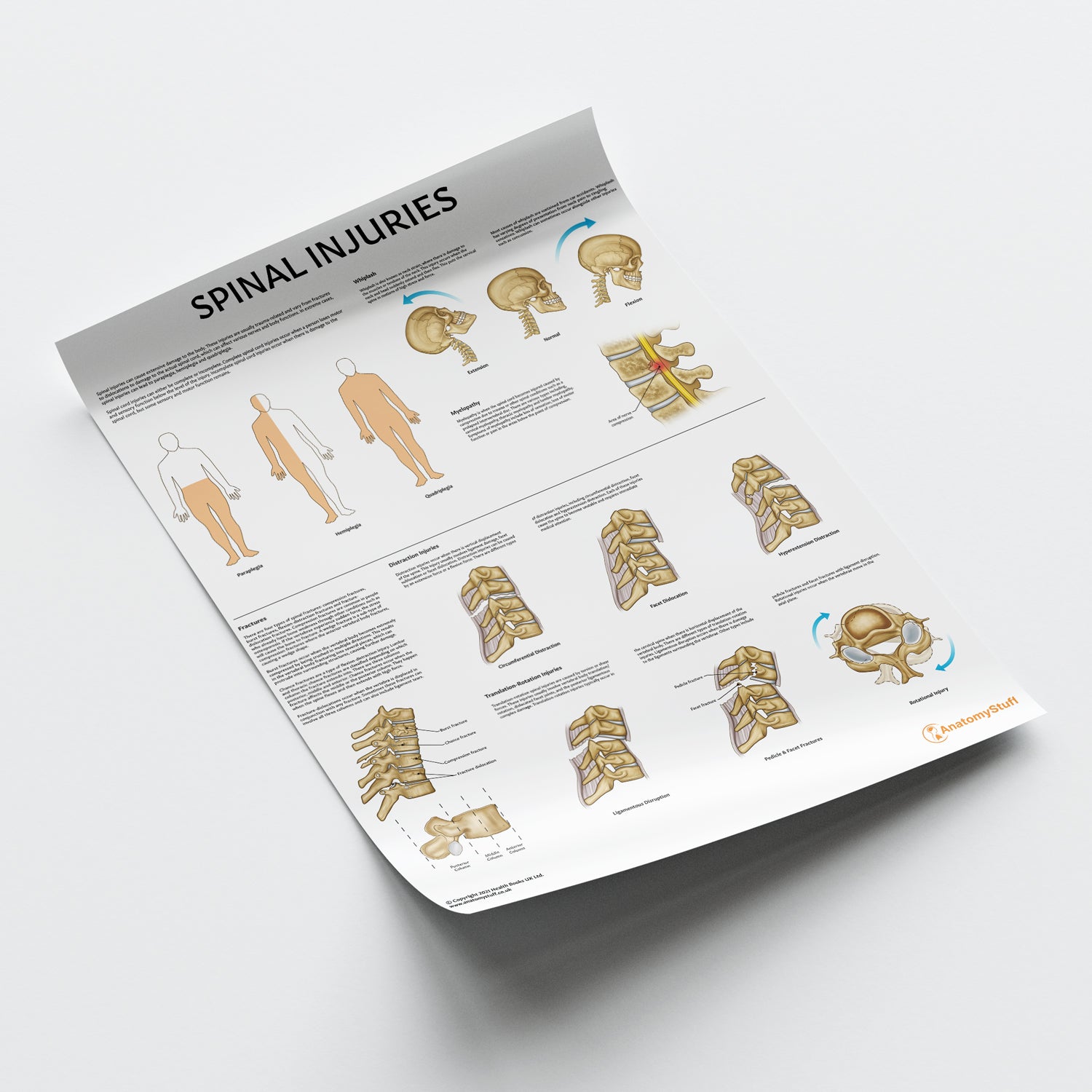 Spinal Injuries Chart / Poster - Part of Collection