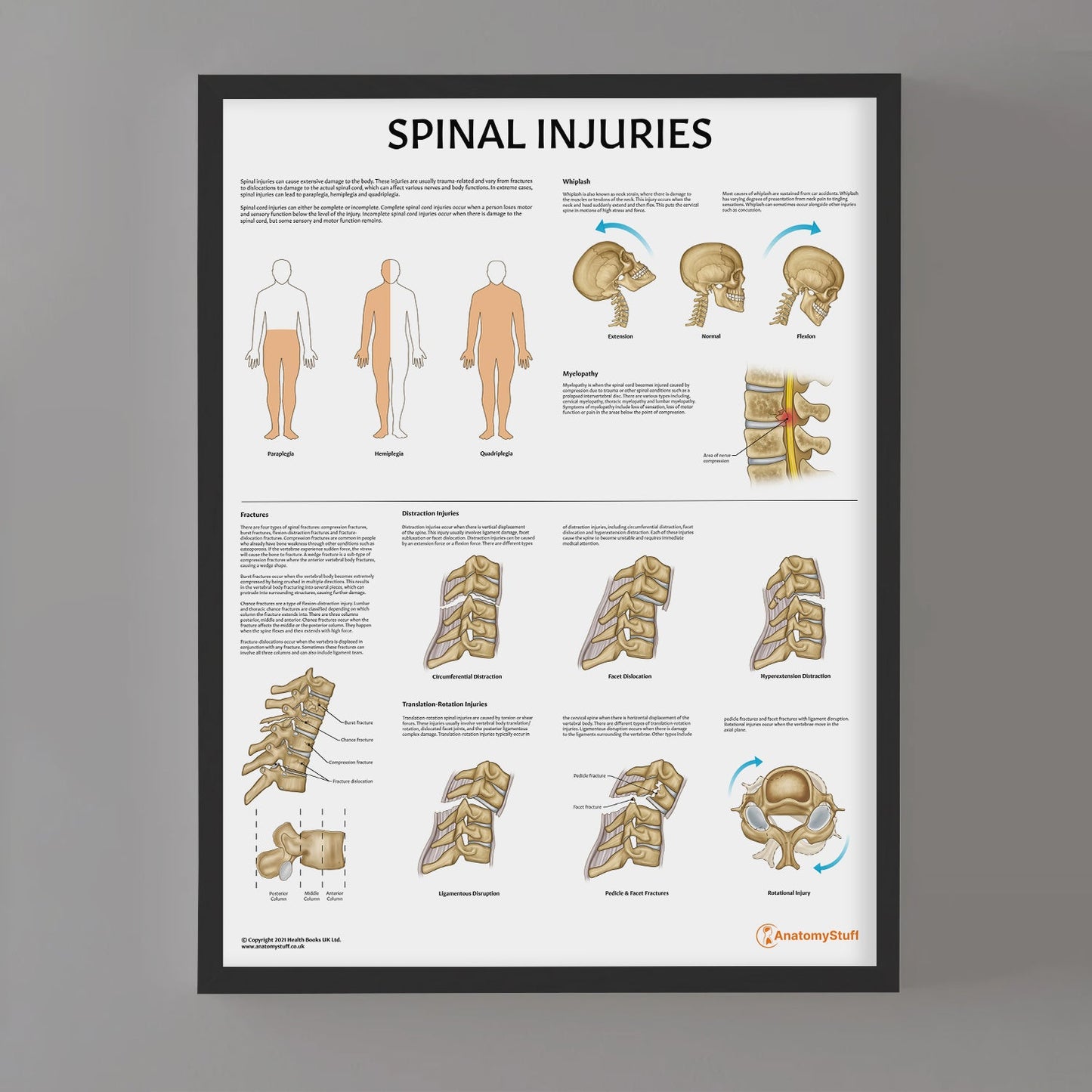 Spinal Injuries Chart / Poster - Part of Collection