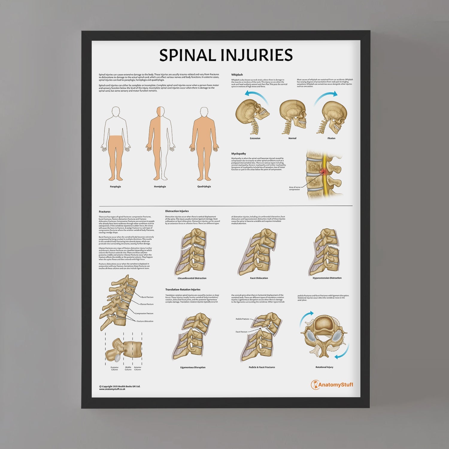 Spinal Injuries Chart / Poster - Part of Collection