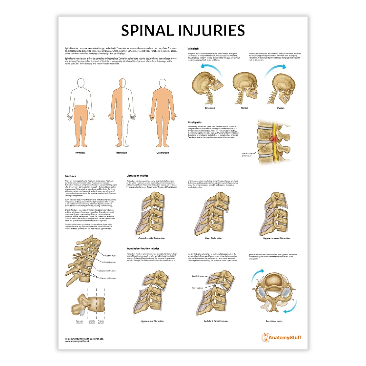 Spinal Injuries Chart / Poster - Part of Collection