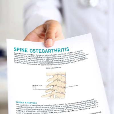 Spine Osteoarthritis Patient Education Handout (Printable PDF)