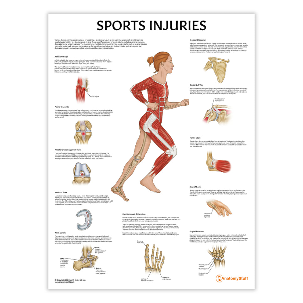 Sports Injuries Chart / Poster