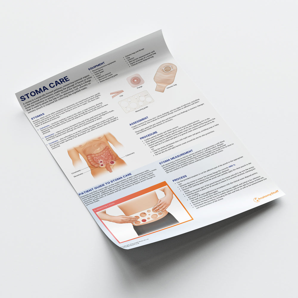 Stoma Care Chart | Ostomy Assessment Poster | AnatomyStuff