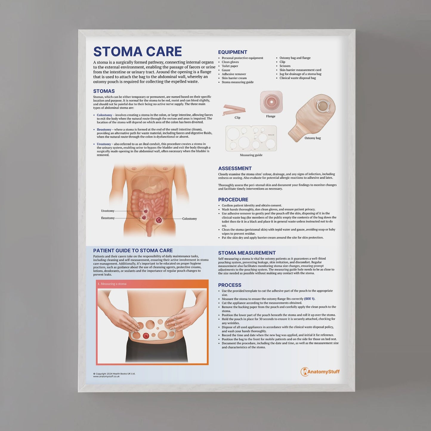 Stoma Care Chart / Poster - Part of Collection
