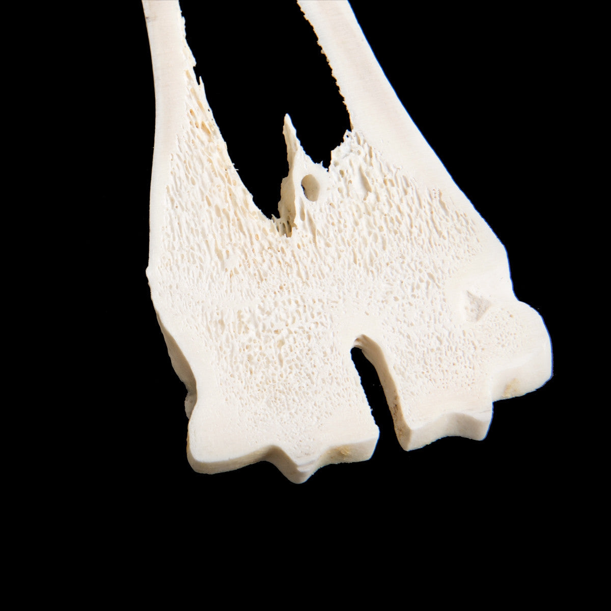 Mammalian Metacarpal and Metatarsal Bones Display