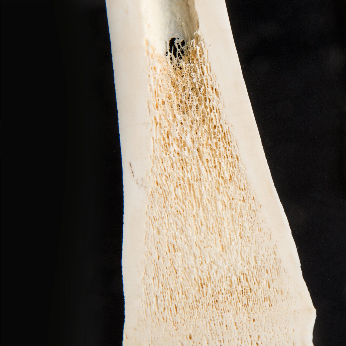 Mammalian Metacarpal and Metatarsal Bones Display