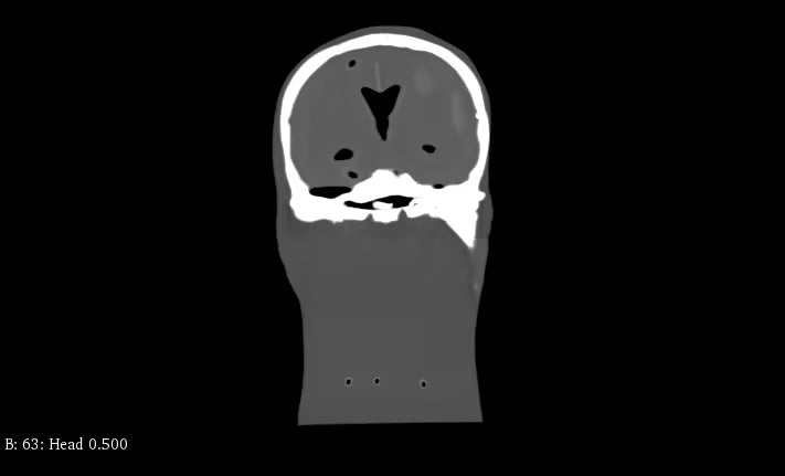 Adult Head (Standard) for X-Ray CT, US, MRI HD-A03 image 17