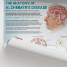 Switch The Anatomy of Alzheimer&#39;s Disease Chart / Poster 2 image