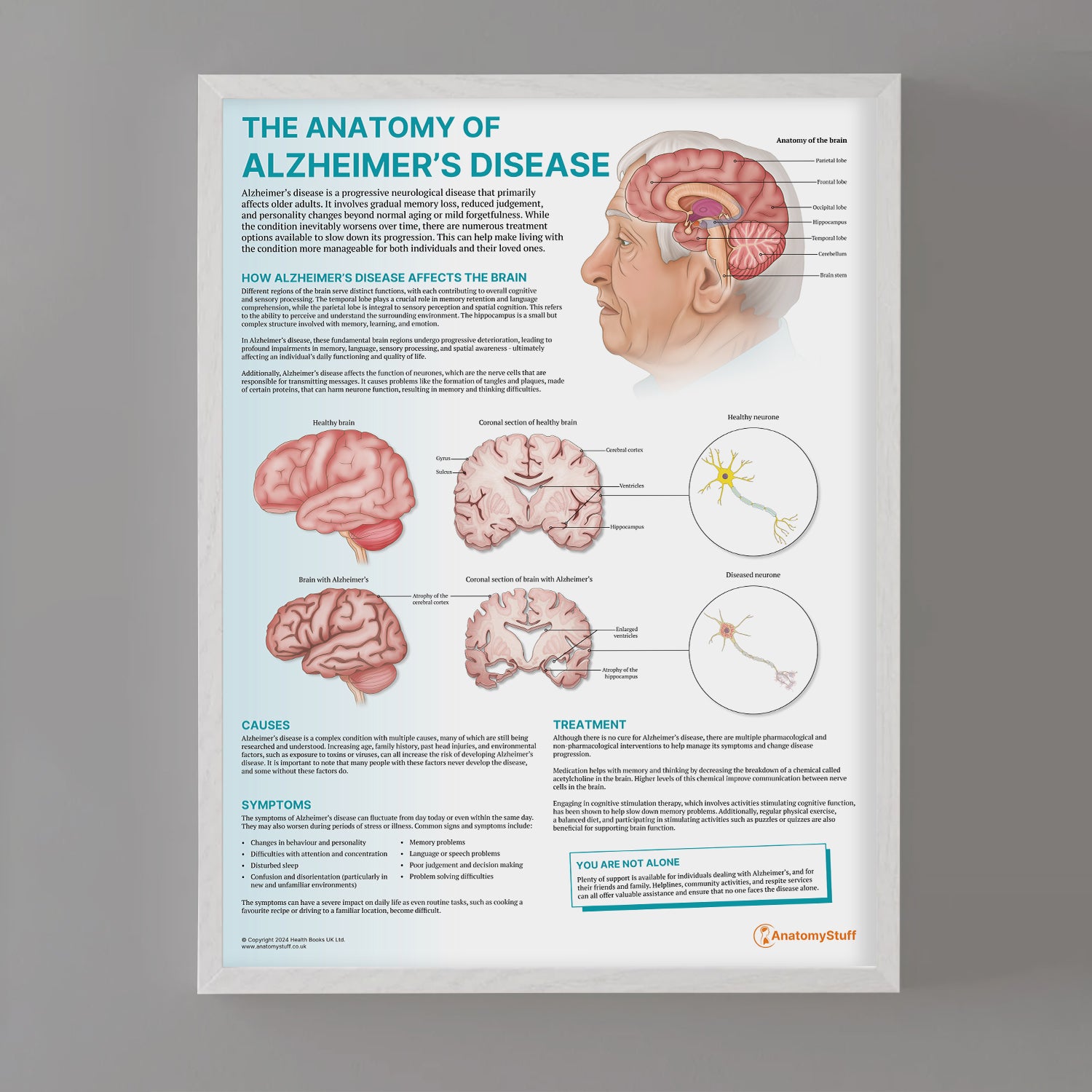 The Anatomy of Alzheimer's Disease Chart / Poster