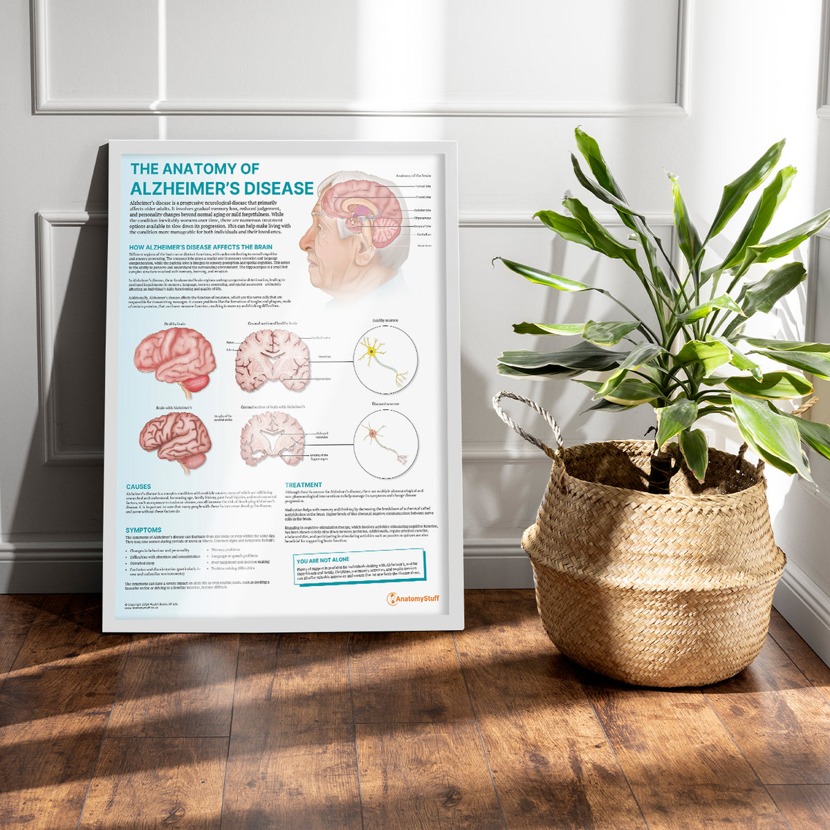 The Anatomy of Alzheimer's Disease Chart/Poster Laminated | AnatomyStuff
