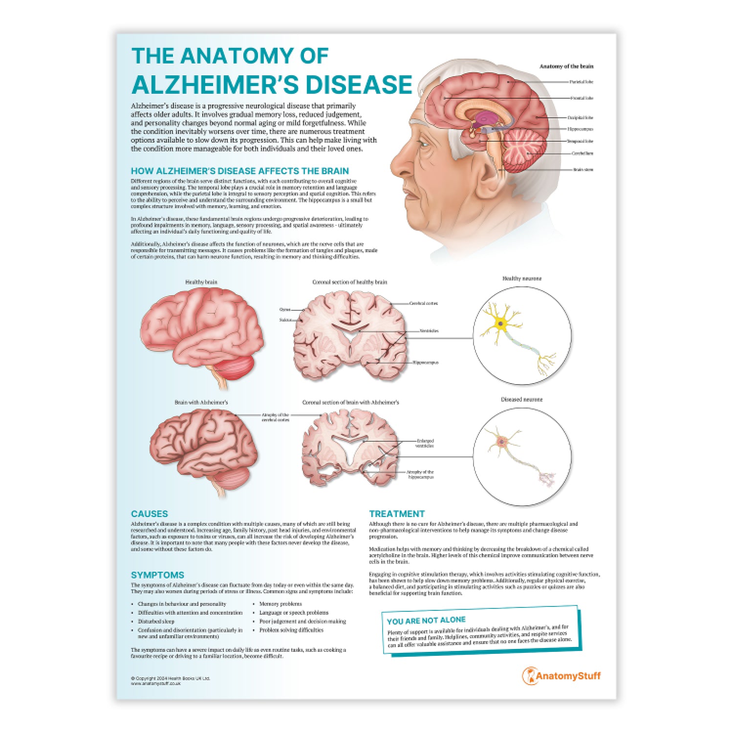 The Anatomy of Alzheimer's Disease Chart / Poster