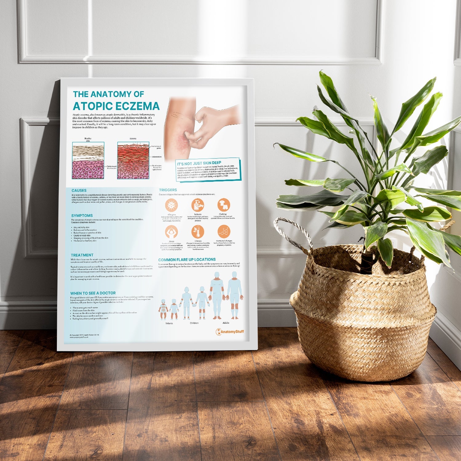 The Anatomy of Atopic Eczema Chart / Poster - Part of Collection