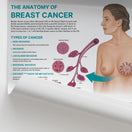 Switch The Anatomy of Breast Cancer Chart / Poster 2 image
