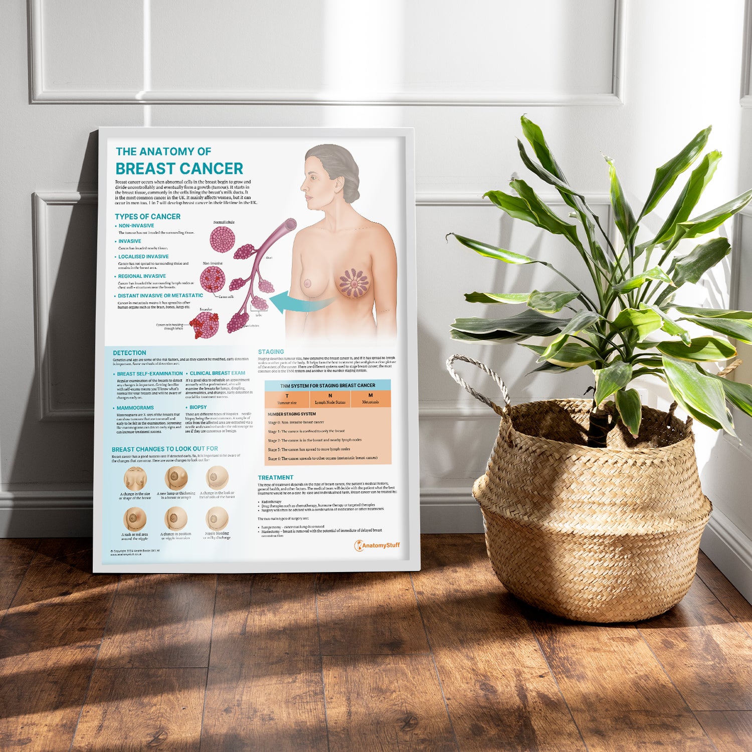 The Anatomy of Breast Cancer Chart / Poster