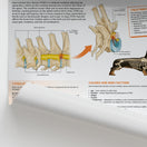 Switch The Anatomy of Canine Intervertebral Disc Disease Chart / Poster 2 image