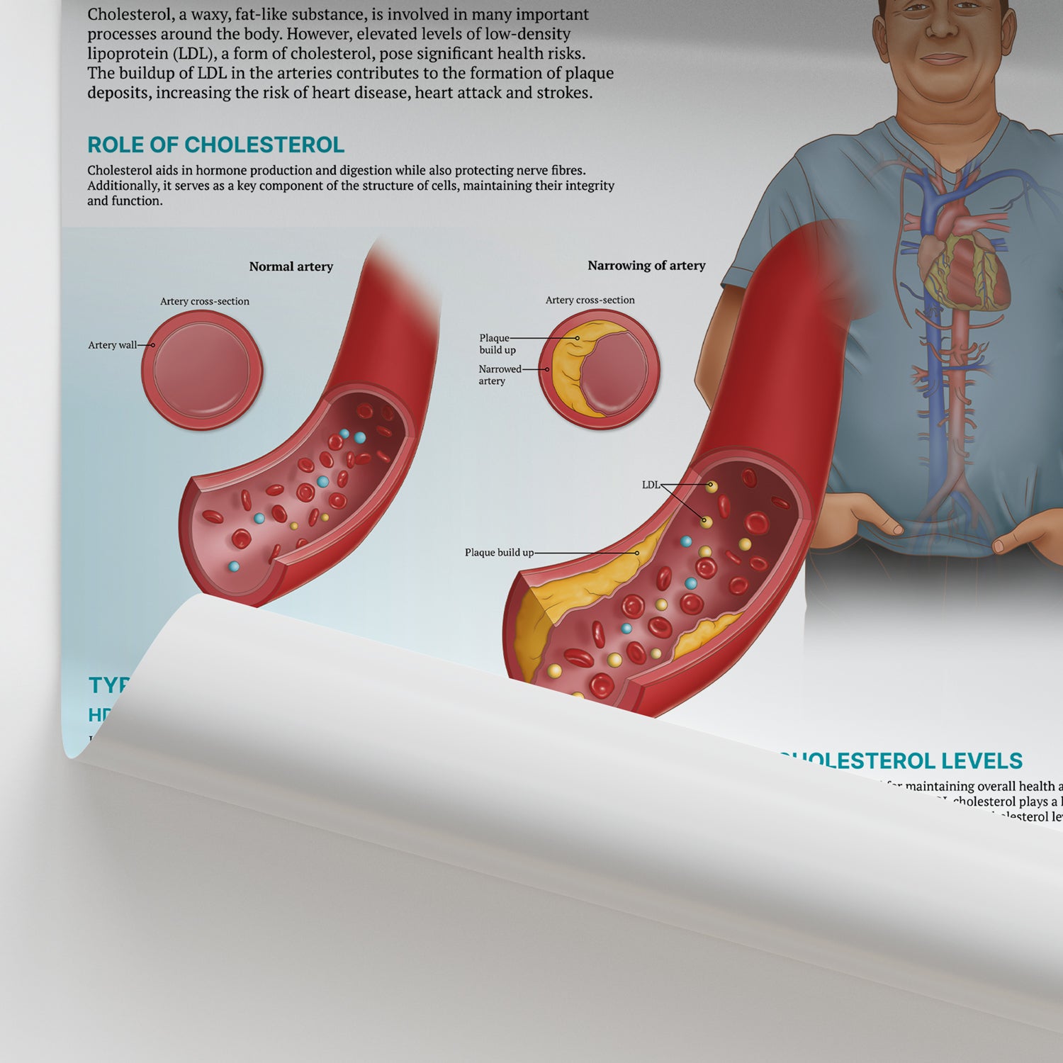 The Anatomy of Cholesterol Chart / Poster