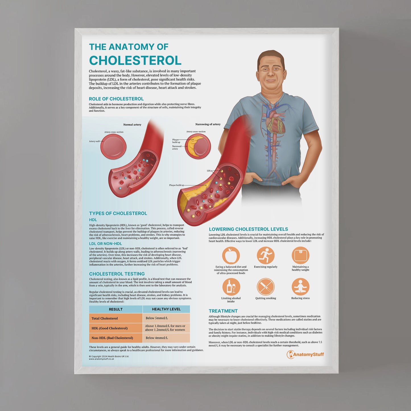 The Anatomy of Cholesterol Chart / Poster