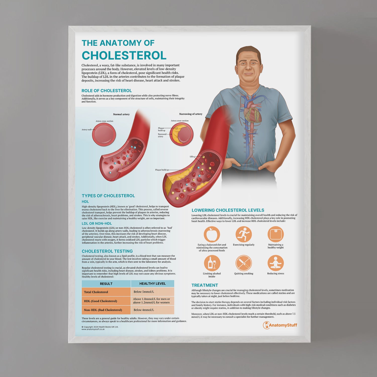 The Anatomy of Cholesterol Chart / Poster