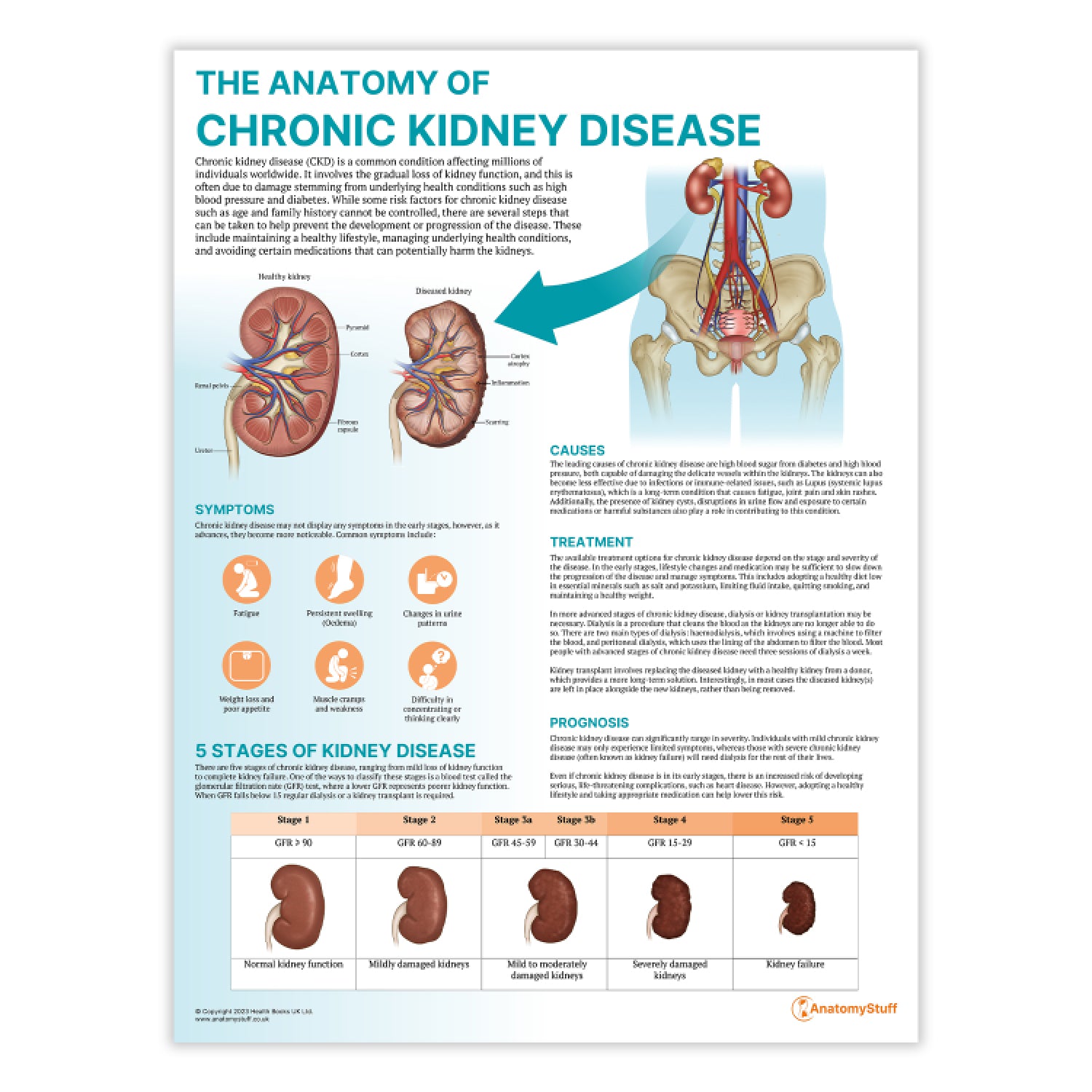 5 Stages Of Kidney Disease Chronic Kidney Disease And The Global