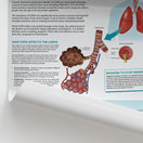Switch The Anatomy of COPD Chart / Poster 2 image