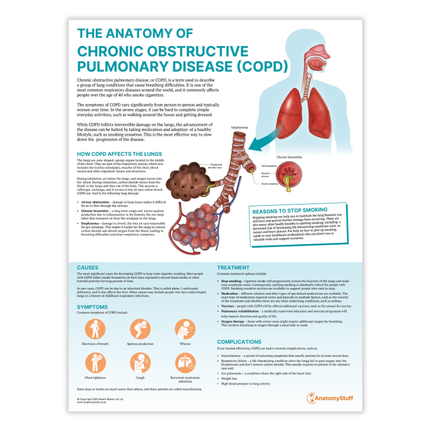 The Anatomy of COPD Chart / Poster