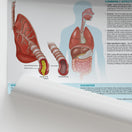 Switch The Anatomy of Cystic Fibrosis Chart / Poster 2 image