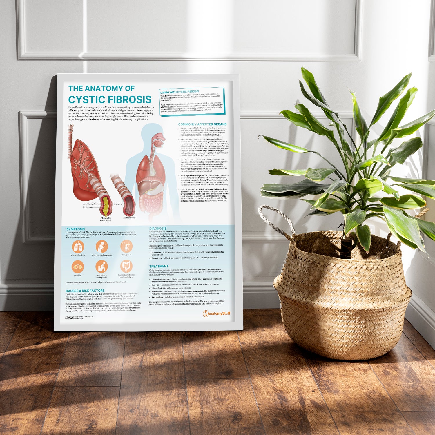 The Anatomy of Cystic Fibrosis Chart / Poster
