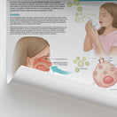 Switch The Anatomy of Hay Fever Chart / Poster 3 image