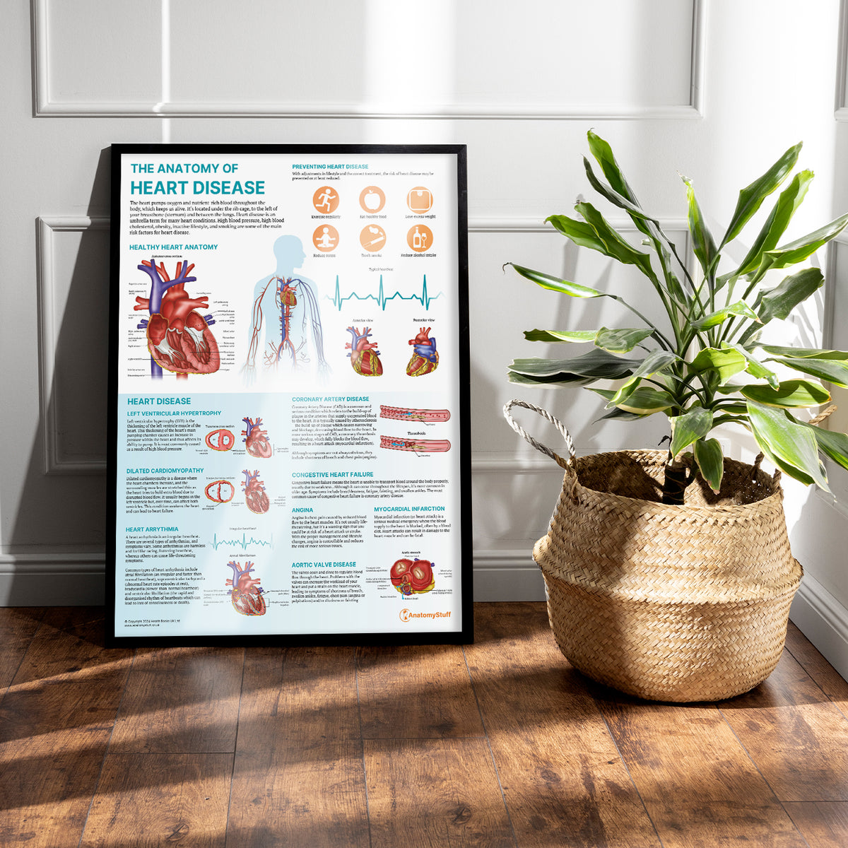 Heart Problem Chart The Anatomy of Heart Disease Chart/Poster Laminated | Cardiovascular ...