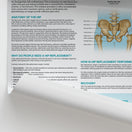 Switch The Anatomy of Hip Replacement Chart / Poster 2 image