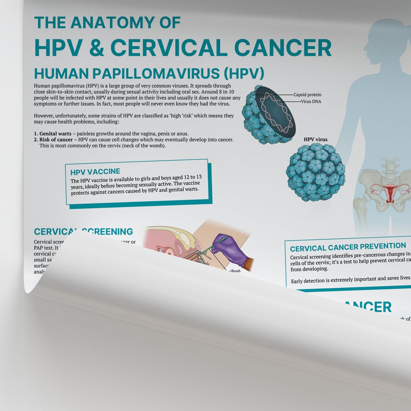 The Anatomy of HPV & Cervical Cancer Chart / Poster - Part of Collection