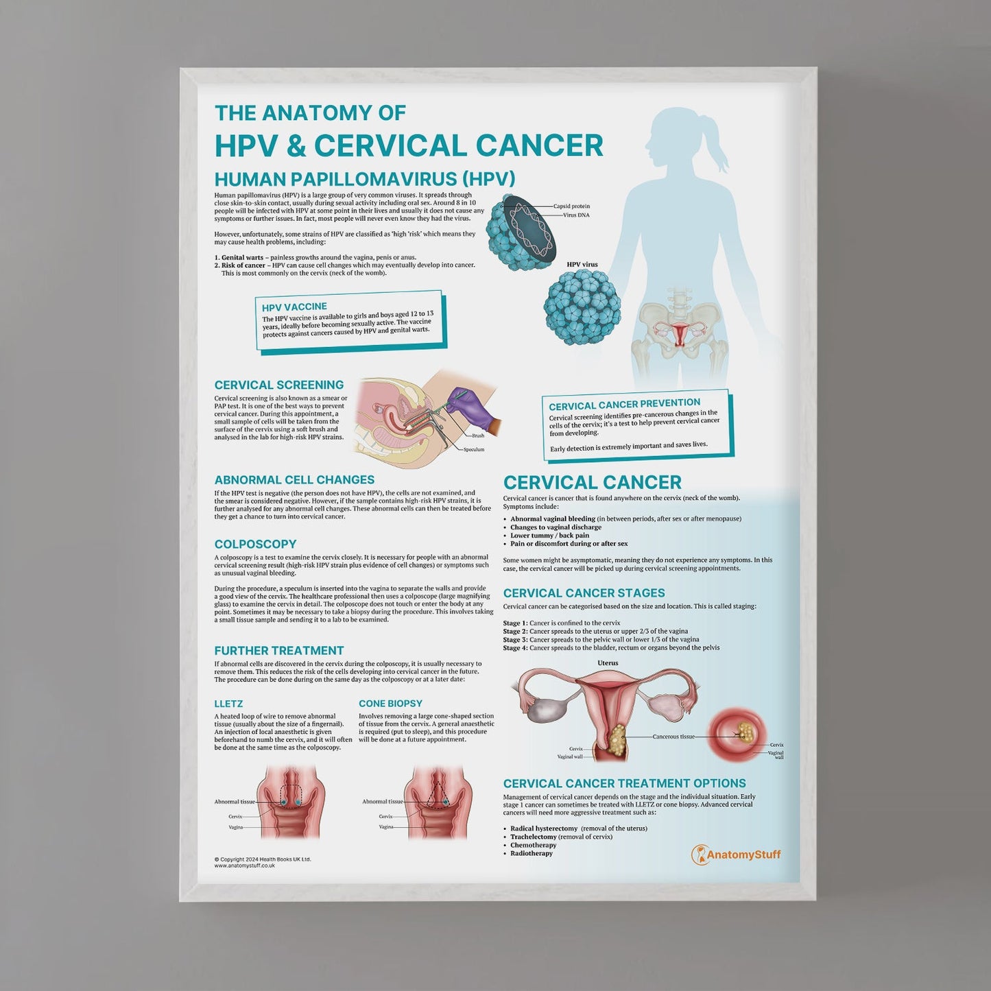 The Anatomy of HPV & Cervical Cancer Chart / Poster - Part of Collection