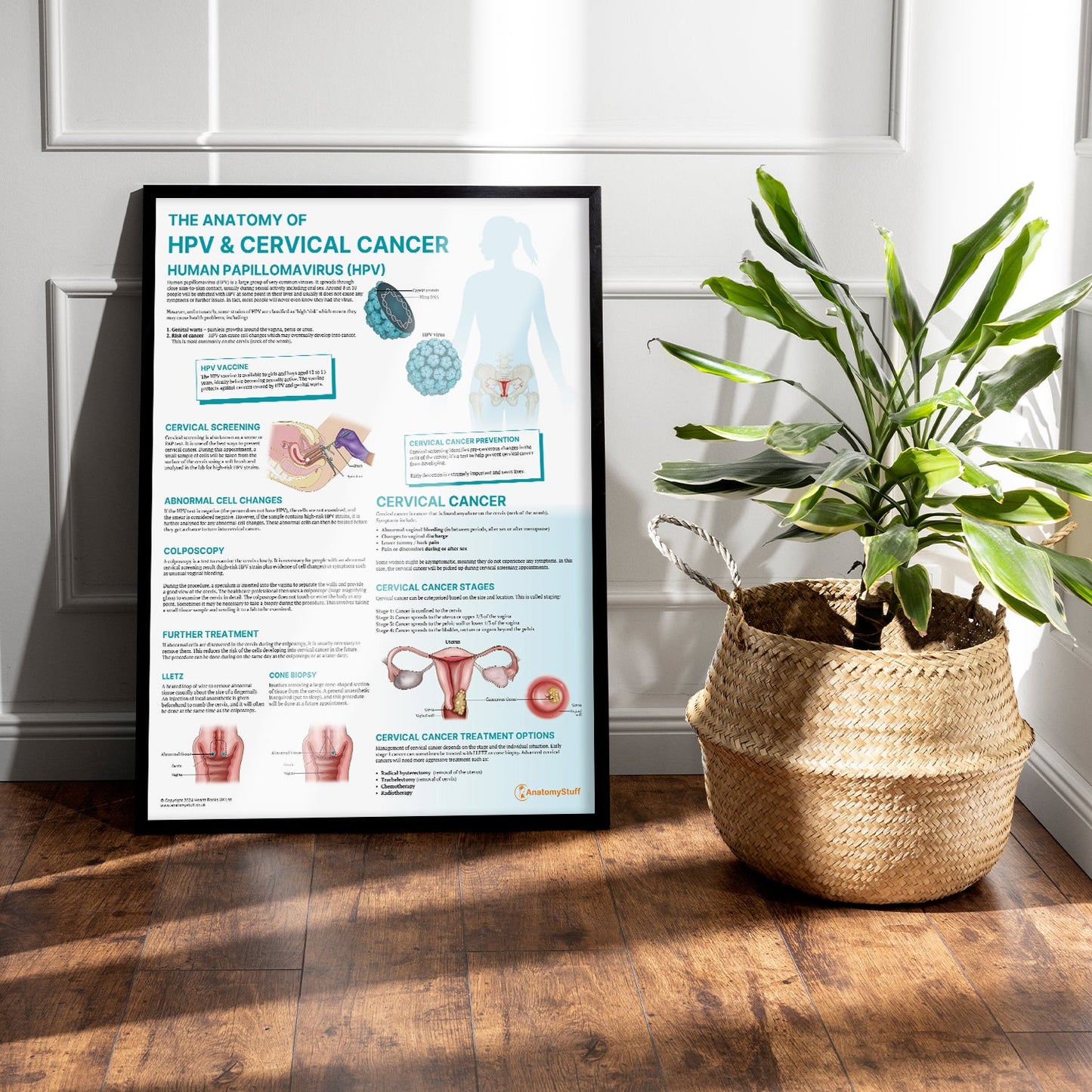The Anatomy of HPV & Cervical Cancer Chart / Poster - Part of Collection