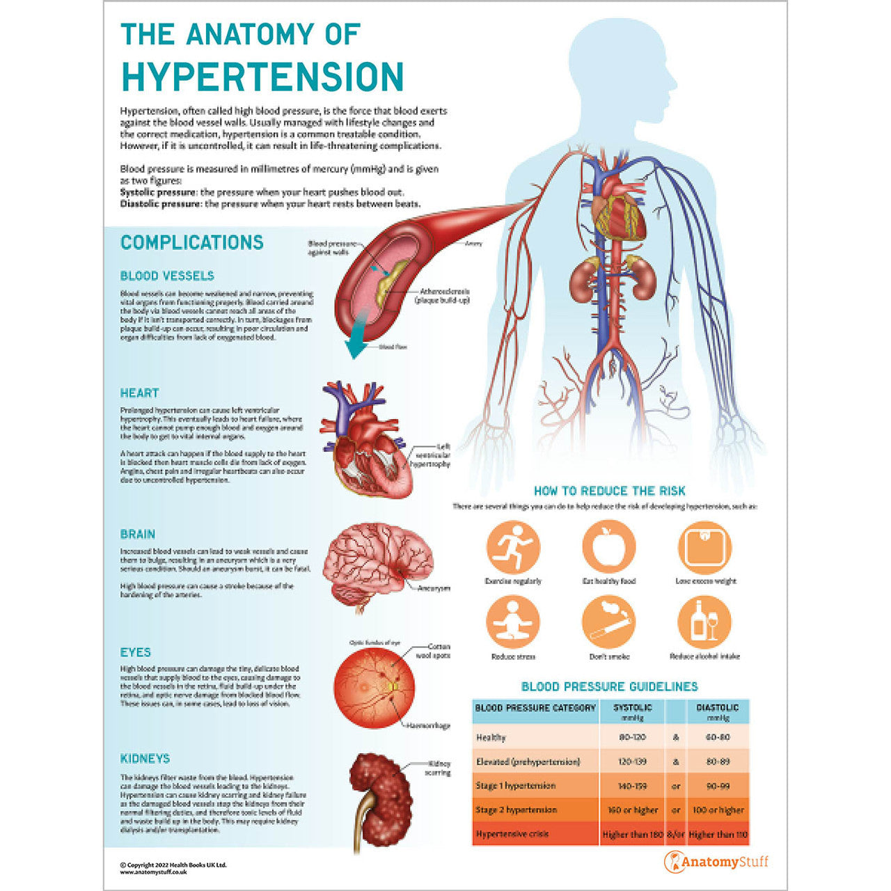 Anatomy of Hypertension Poster