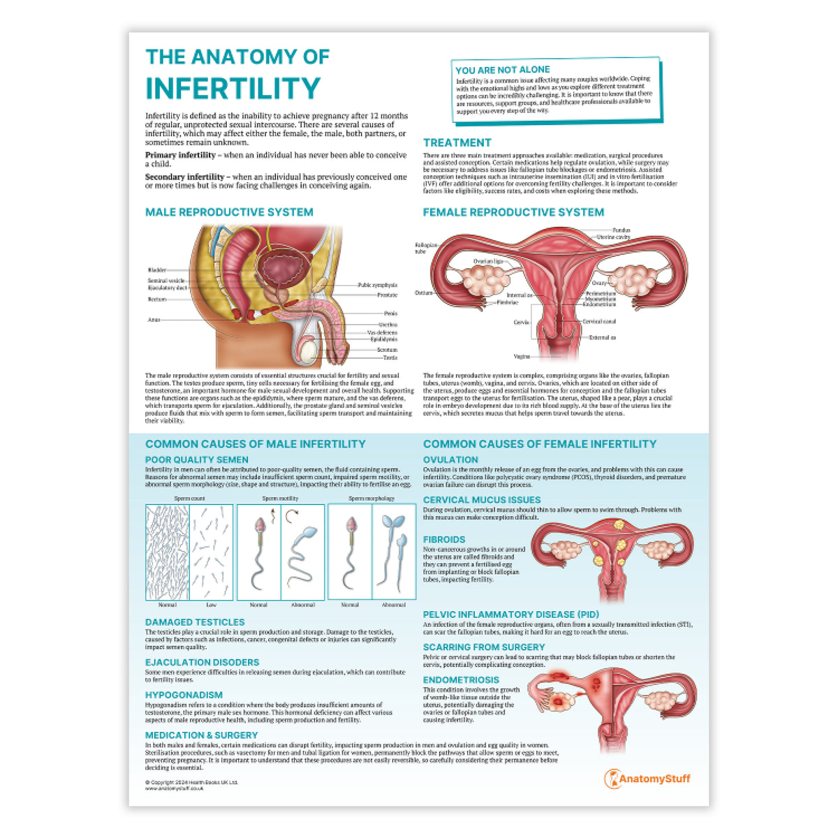 Infertility Introduction The Anatomy of Infertility Chart / Poster - | AnatomyStuff