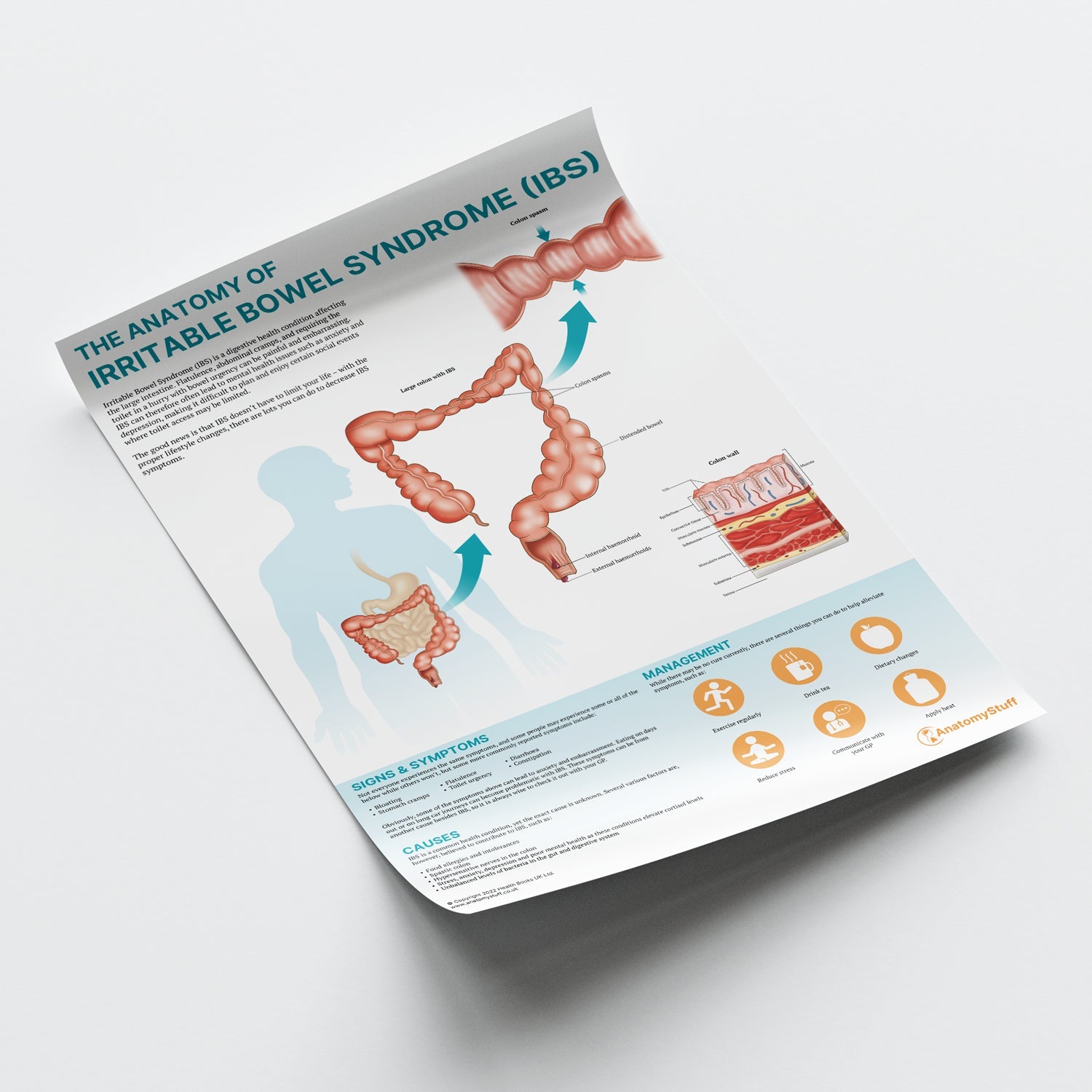 The Anatomy of Irritable Bowel Syndrome (IBS) Chart / Poster - Part of Collection