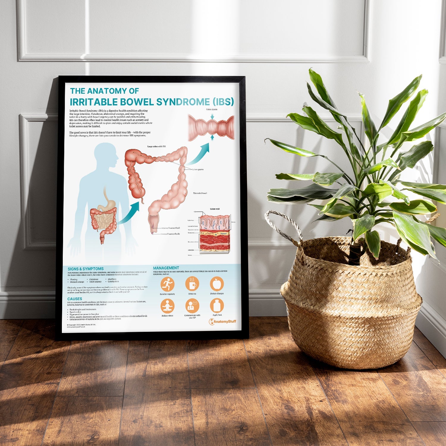 The Anatomy of Irritable Bowel Syndrome (IBS) Chart / Poster - Part of Collection