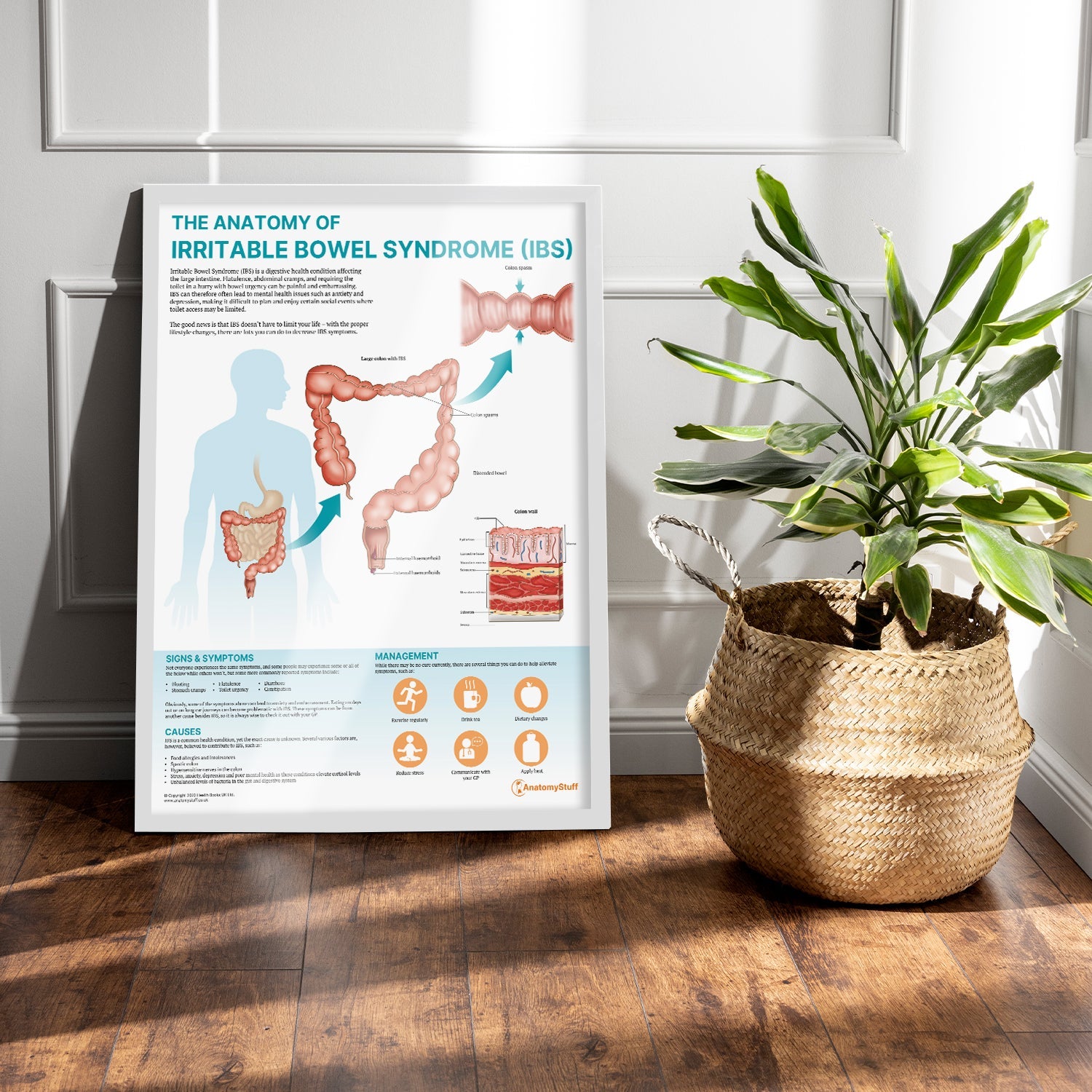 The Anatomy of Irritable Bowel Syndrome (IBS) Chart / Poster - Part of Collection