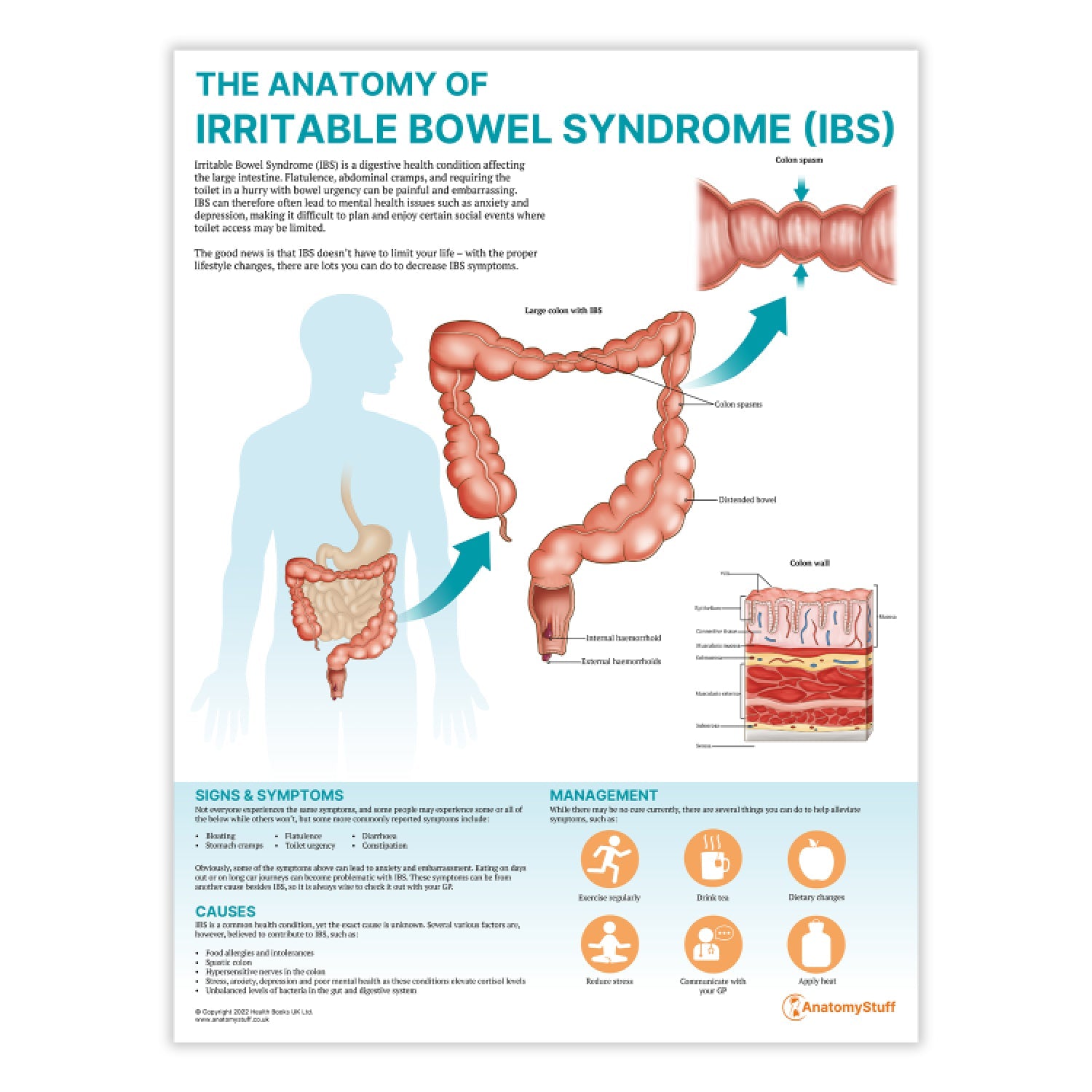 The Anatomy of Irritable Bowel Syndrome (IBS) Chart / Poster - Part of Collection