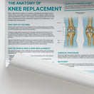 Switch The Anatomy of Knee Replacement Chart / Poster 2 image
