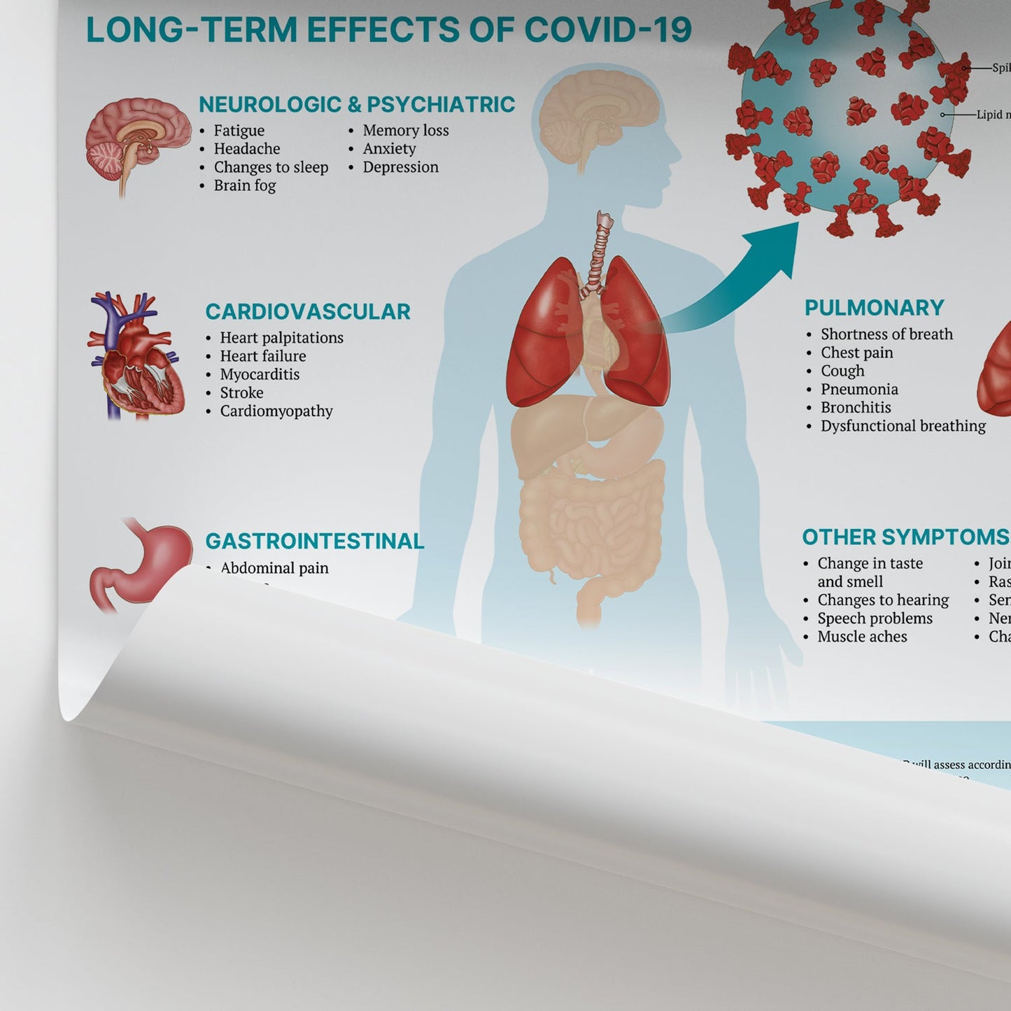 The Anatomy of Long COVID Chart / Poster - Part of Collection